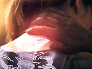 Atlantoaxial Dislocation