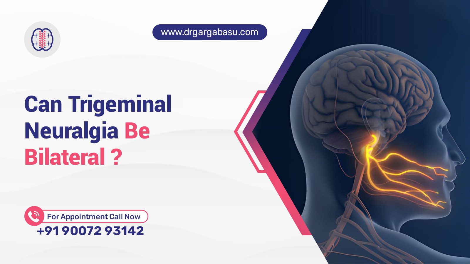 Can Trigeminal Neuralgia Be Bilateral