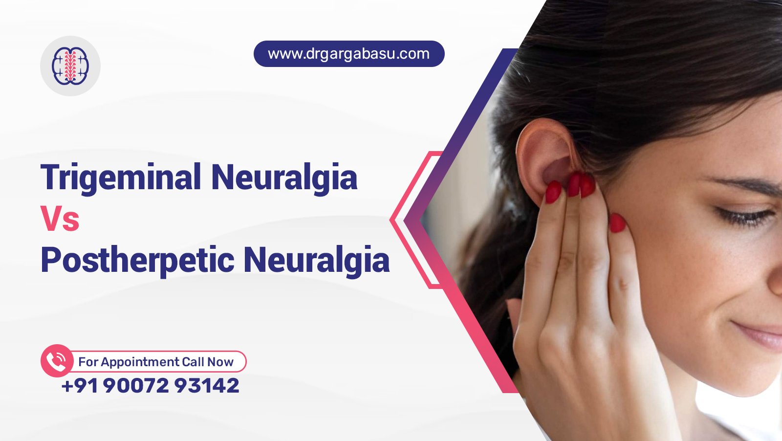 Trigeminal Neuralgia vs Postherpetic Neuralgia Key Differences Explained